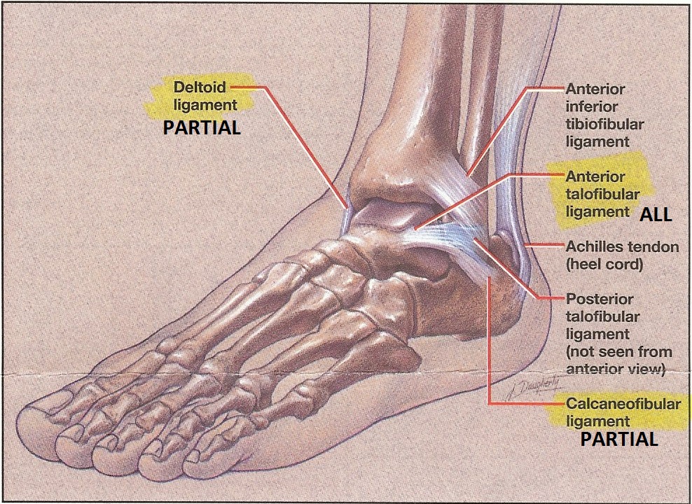 Ligamentation